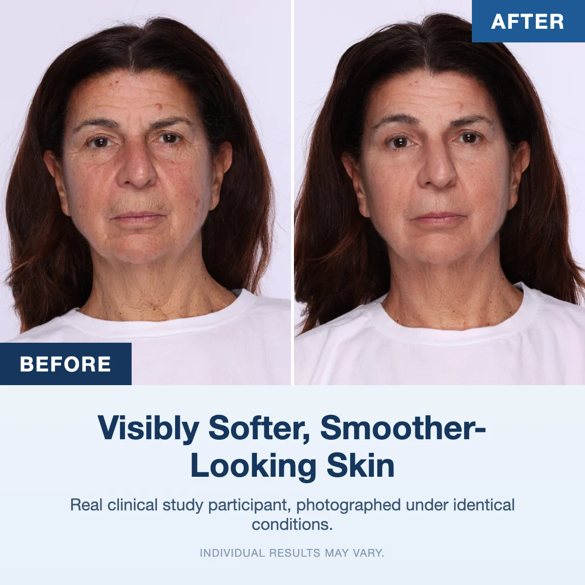 Before and after skin results