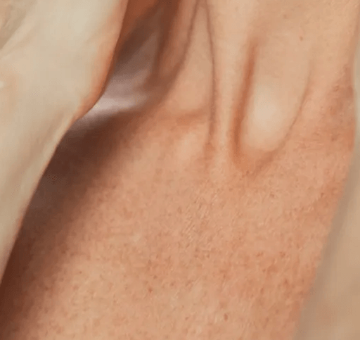 Chest/Decolletage